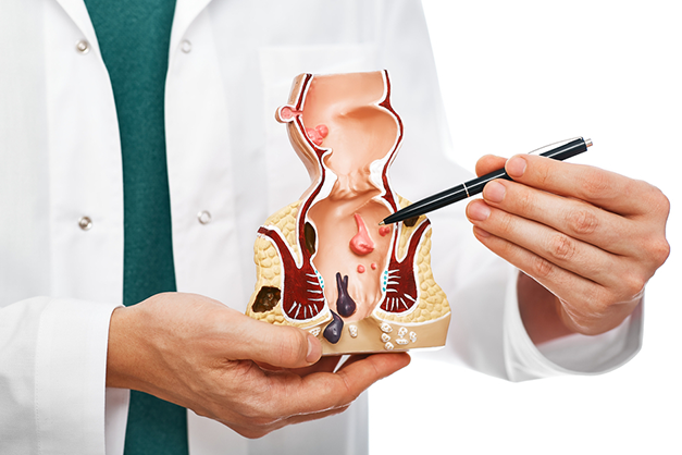                                               علاج البواسير بالليزر
                                              